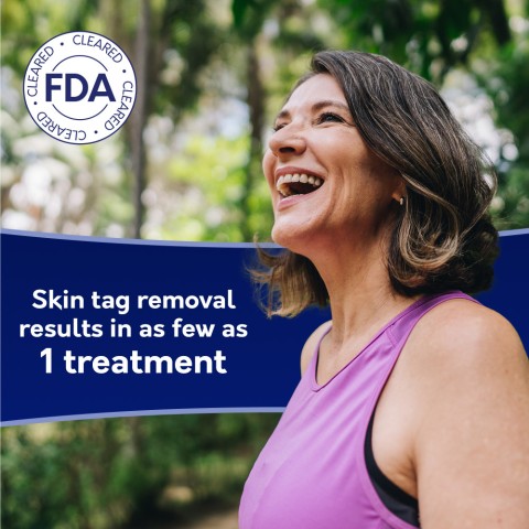 Compound W Freeze Off Skin Tag Remover